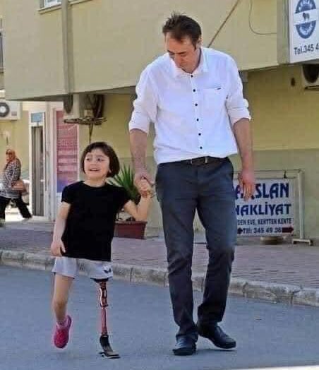 ozlemhelvaci24's tweet photo. Antalya'da 6,5 aylık dünyaya gelip, 13 günlükken sol bacağı kesilen 6 yaşındaki kızı Özge’nin yürüyebilmesi için evinin tavanında 150 TL maliyetle kurduğu düzenekle kızına yürümeyi öğreten alüminyum doğrama ustası baba Ali ihsan yıldırım bu sefer kızının koşabilmesi için 
++👇 https://t.co/Rspniq6153