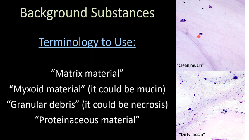 juliagallardo23's tweet photo. Basic concepts of cytopathology @cjvand #CAPVirtualPath #CytoPath https://t.co/0twKbiwf1E