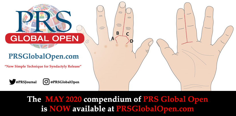 The new compendium of #PRSGlobalOpen is available now!

Read amazing #FREE articles, like "New Simple Technique for Syndactyly Release": bit.ly/SyndactylyRele…
