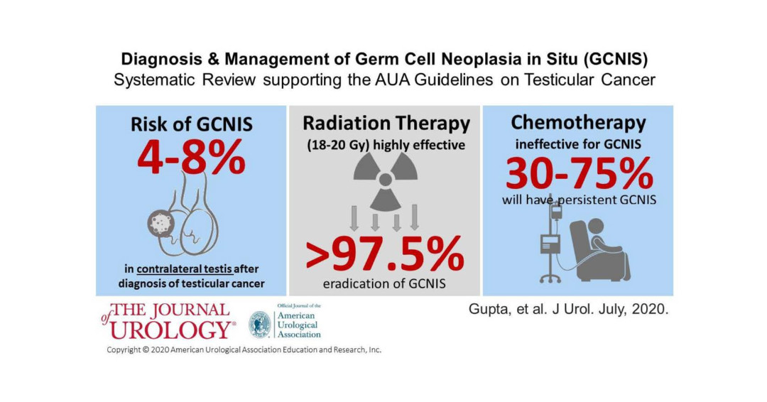 JUrology's tweet photo. GCNIS present in other testicle 4-8%
50% will develop another #testicularcancer if untreated
Radiation (18-20Gy) >97% cure
Chemo less effective
#SysReview for @AmerUrological Guideline
Analysis by @MGuptaMD @JosephCheaib @HitenDPatel @drphil_urology
https://t.co/u2NxVTVYay https://t.co/IeGULA59yj