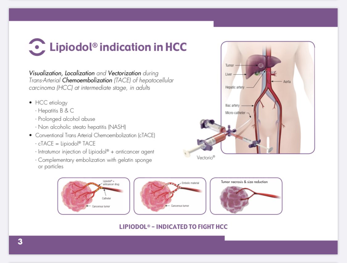 ContrastForLife's tweet image. Vectorio® By GUERBET