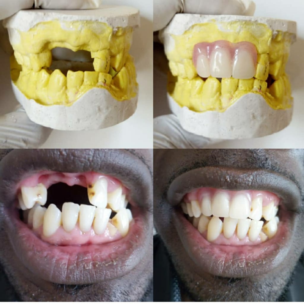 HQ dental ( high quality Dental Est) (@movicati) on Twitter photo 