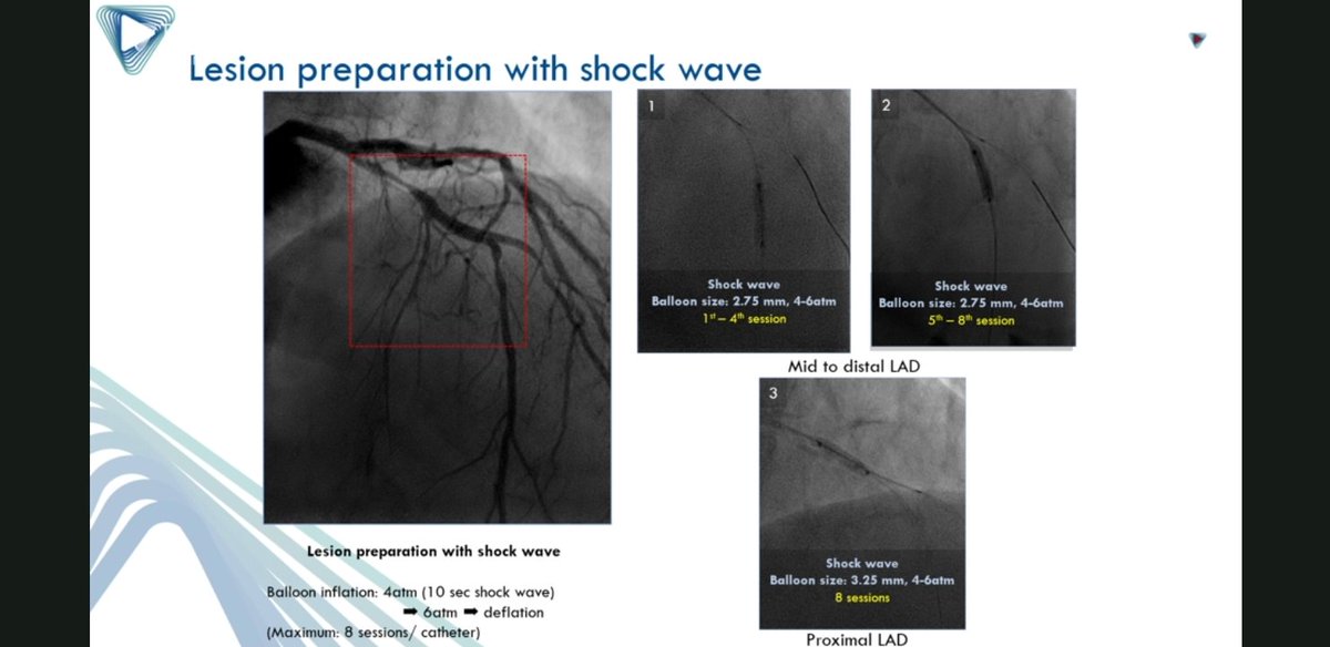 AmitSinghMD's tweet photo. @azeemlatib sir, excellent presentation at @radcliffeCARDIO #TIOJune2020 sessions. Enjoyed thoroughly. https://t.co/KsirdKlqHQ
