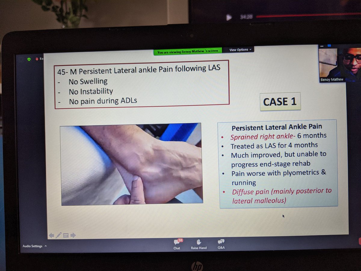 Brilliant webinar tonight with <a href="/martinthomas11/">First Contact Physio</a> <a href="/function2fitnes/">Benoy Mathew</a> <a href="/emarlow89/">Lizzie Marlow 💙</a> 

Great cause studies! 

Looking forward to part 2!