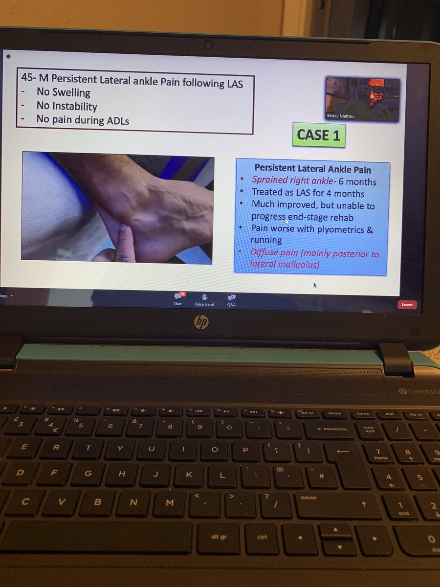 BenBrownPhysio's tweet photo. Great webinar tonight on PTTD in recreational runners by @emarlow89 followed by some very relevant case studies by @function2fitnes. Lots to take away again and help develop my practice 👍 https://t.co/Z4vNlfhE7q
