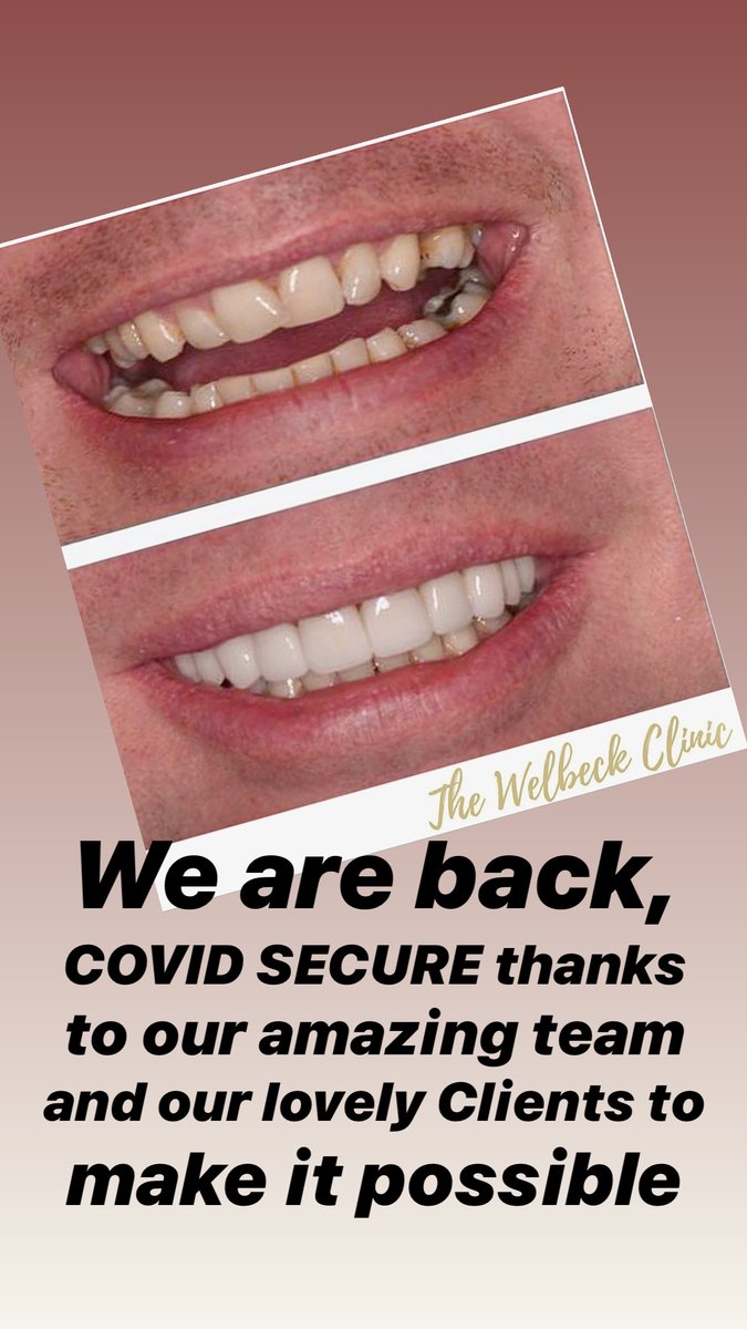 SurreyDentalSpa's tweet photo. We are back, the week has gone amazingly well so far, thanks to all our clients and our amazing team making it possible for us to be The COVID SECURE PRACTICE @thewelbeckclinic. #porcelainveneers #cosmeticdentist #designer #designersmile #drilaty
#veneers https://t.co/IEQ8G5jMK7