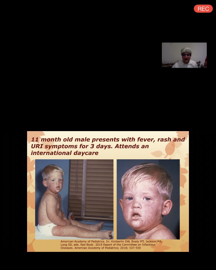 horyah236's tweet photo. شعور جميل تتعلم بدون ضغط و اختبارات .. 💓🙃 
Pediatric MD revisions 👶🏻 https://t.co/AncCnIL5Hl