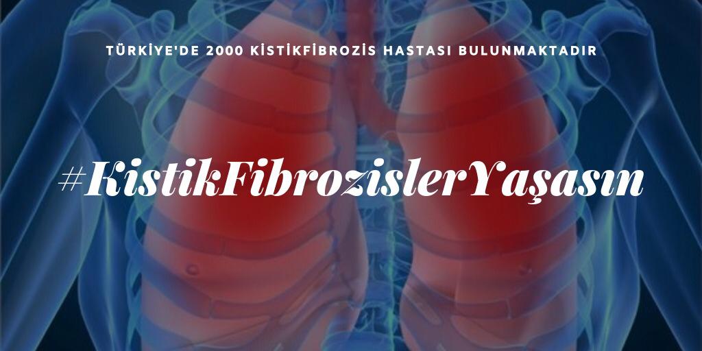emre41ks's tweet photo. Kistik Fibrozis mutasyon ilaçları geri ödemeye alınsın;çocuklarımızın ilaç saatleri değil oyun saatleri olsun istiyoruz.Onlara sağlıklı bir yaşam hediye edin. #KistikFibrozislerYaşasın @RTErdogan @drfahrettinkoca @saglikbakanligi https://t.co/jshdxDH7yB
