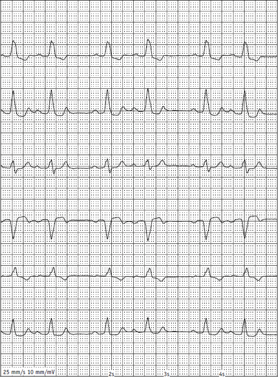 bordistef's tweet photo. Funny bigeminus today... #Epeeps something for @SergioPinski collection? https://t.co/BM7Fa0wC3Q