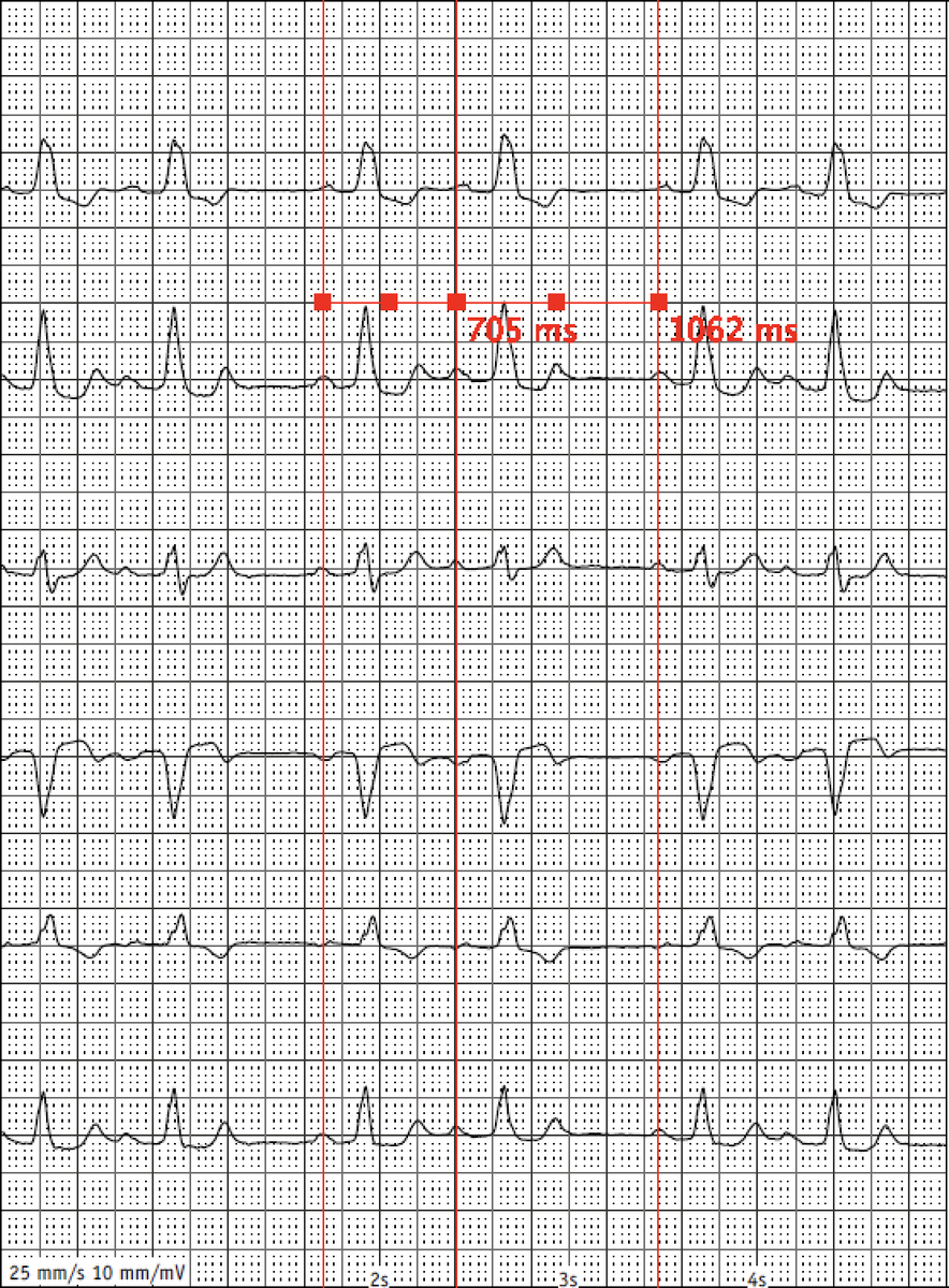 bordistef's tweet photo. Funny bigeminus today... #Epeeps something for @SergioPinski collection? https://t.co/BM7Fa0wC3Q