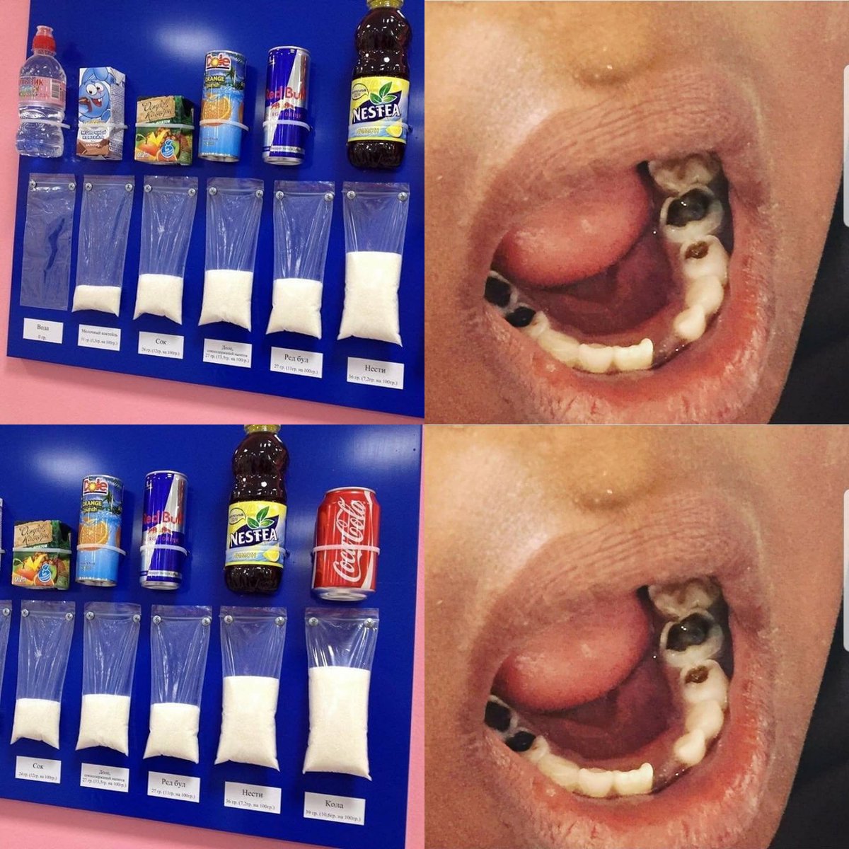 MaasaiMolar's tweet photo. Please don't give sugary drinks to children, just water or milk. Children's teeth have much thinner enamel, the tough outer layer and are much more susceptible to decay. #prevention #dentistry24 #toothbrushes #dentalhealth #oralhealth #dentalvolunteers https://t.co/LD3la2O7qi