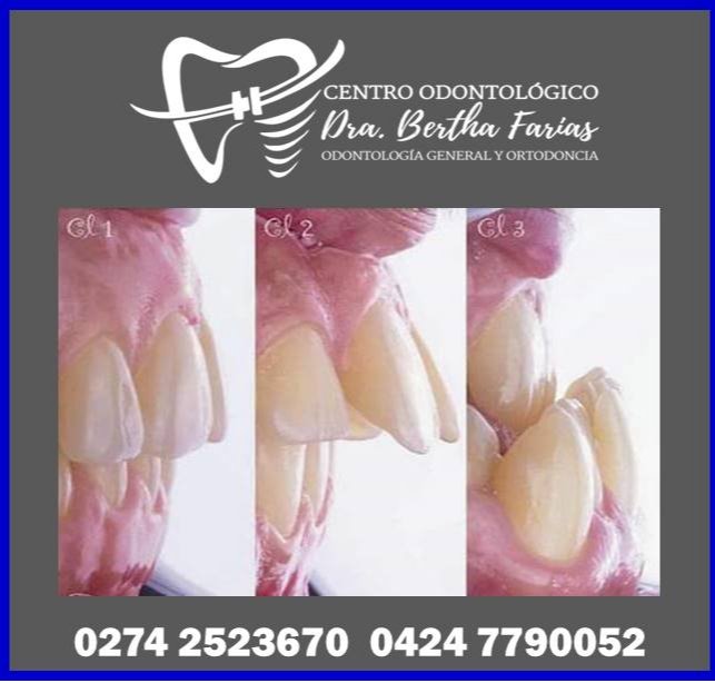 codraberthaf's tweet image. CONSULTAS LUNES, MIÉRCOLES Y VIERNES PREVIA CITA