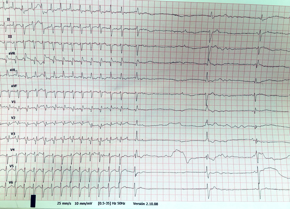 EfectoElectrotónico tweet media