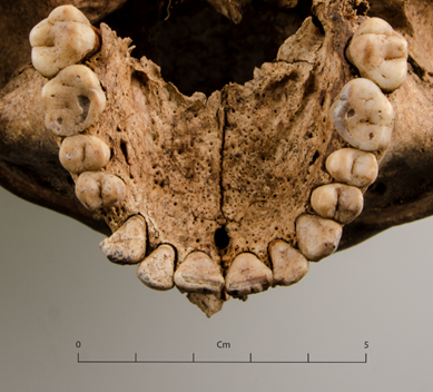 ciarambob's tweet photo. This involves collecting metric &amp;/or non-metric data (traits part of normal variation) from skeletal remains &amp; using statistics to see who groups together. This will be supported by targeted isotope analysis of geographic origin, &amp; spatial analysis of grave location &amp; type. 6/ https://t.co/lX7JBsSpeV