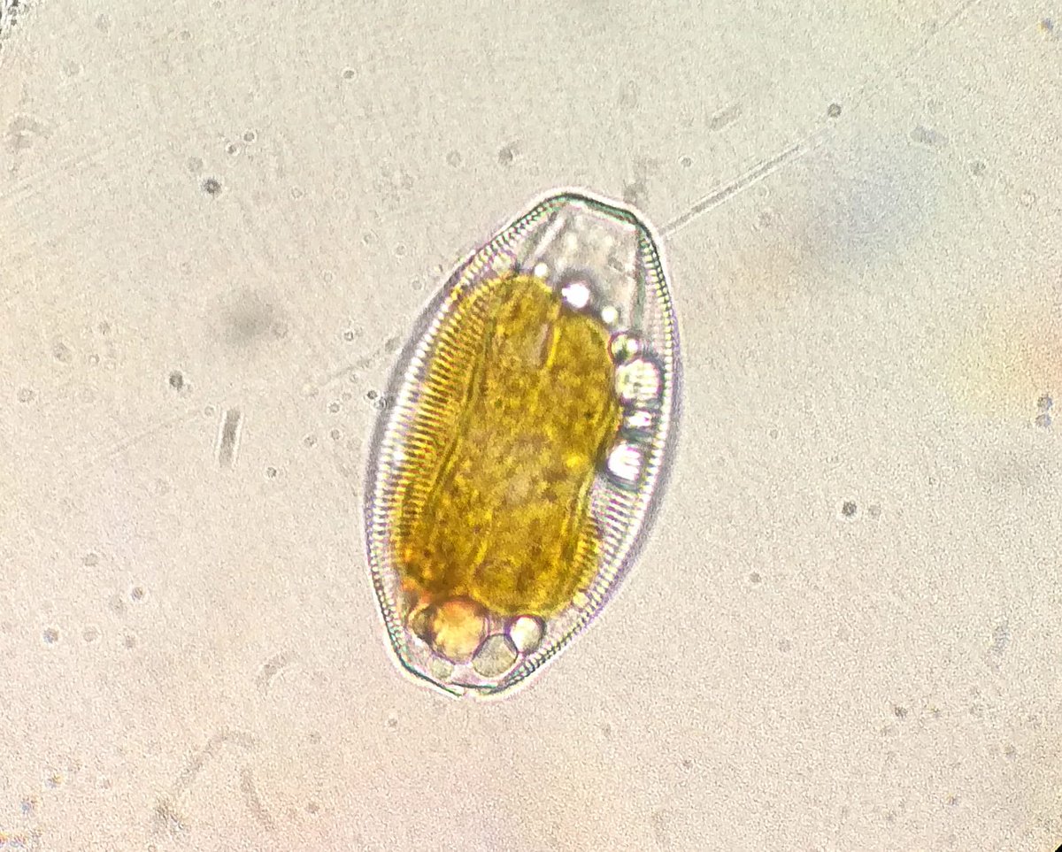 UnitedSpA1's tweet photo. Respiriamo grazie (anche) a loro!
I piccoli invisibili produttori di #ossigeno

#diatomee #microscopia #fitoplancton #ecologia #biodiversita #PasaLabs #GruppoUnited https://t.co/y6p0ijjjUM