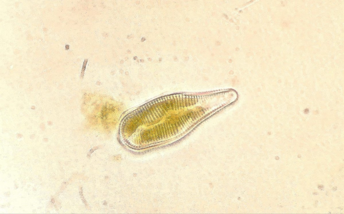 UnitedSpA1's tweet photo. Respiriamo grazie (anche) a loro!
I piccoli invisibili produttori di #ossigeno

#diatomee #microscopia #fitoplancton #ecologia #biodiversita #PasaLabs #GruppoUnited https://t.co/y6p0ijjjUM