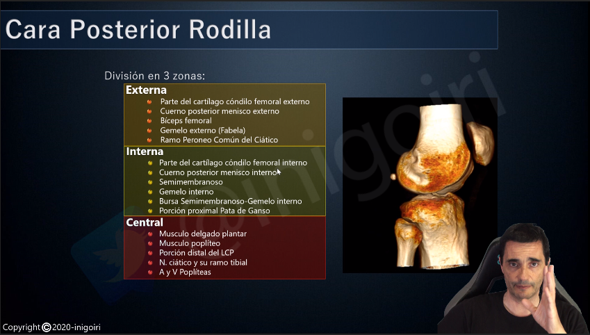 inigoiri's tweet photo. Terminando un nuevo vídeo para mi canal de YouTube:
Ecografía de Rodilla parte 3: Cara posterior
Si quieres estar informado sobre este y próximos vídeos suscríbete a mi canal de Anatomía y Ecografía Musculoesquelética:
https://t.co/lju8qJbGf2 https://t.co/8hDthofkXd