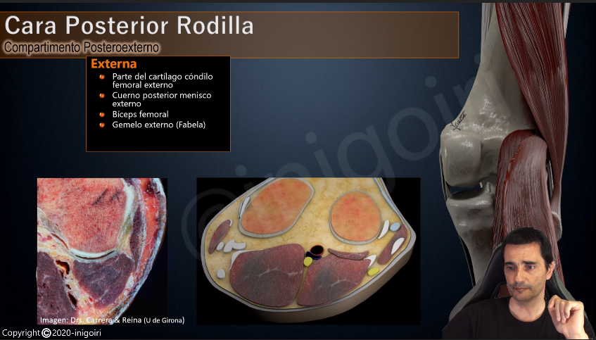 inigoiri's tweet photo. Terminando un nuevo vídeo para mi canal de YouTube:
Ecografía de Rodilla parte 3: Cara posterior
Si quieres estar informado sobre este y próximos vídeos suscríbete a mi canal de Anatomía y Ecografía Musculoesquelética:
https://t.co/lju8qJbGf2 https://t.co/8hDthofkXd