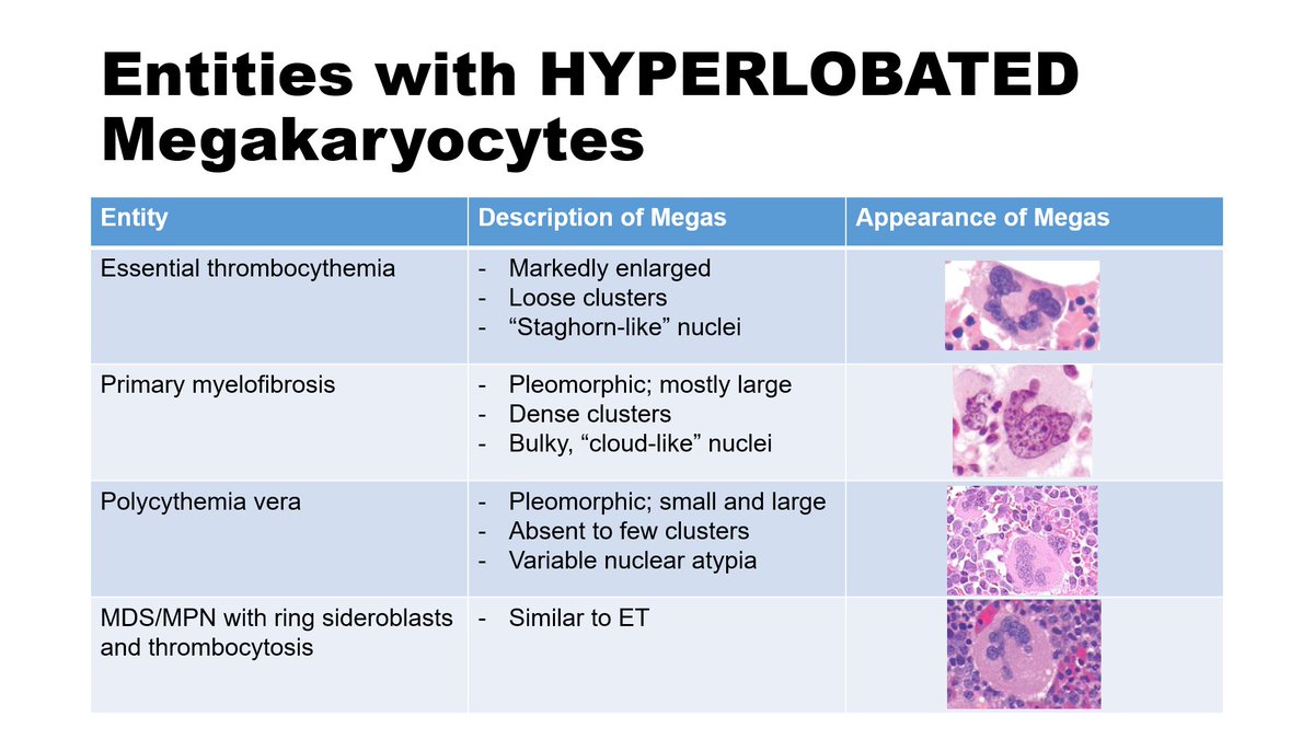 CharlottesWebMD's tweet photo. Studying for #pathboards has me all mixed up with my megakaryocyte morphology so decided to make my own tables. Feel free to use if they help you too! *photos not my own* #hemepath @KMirza @feldstej @pembeoltulu https://t.co/S7MxkAdPuP
