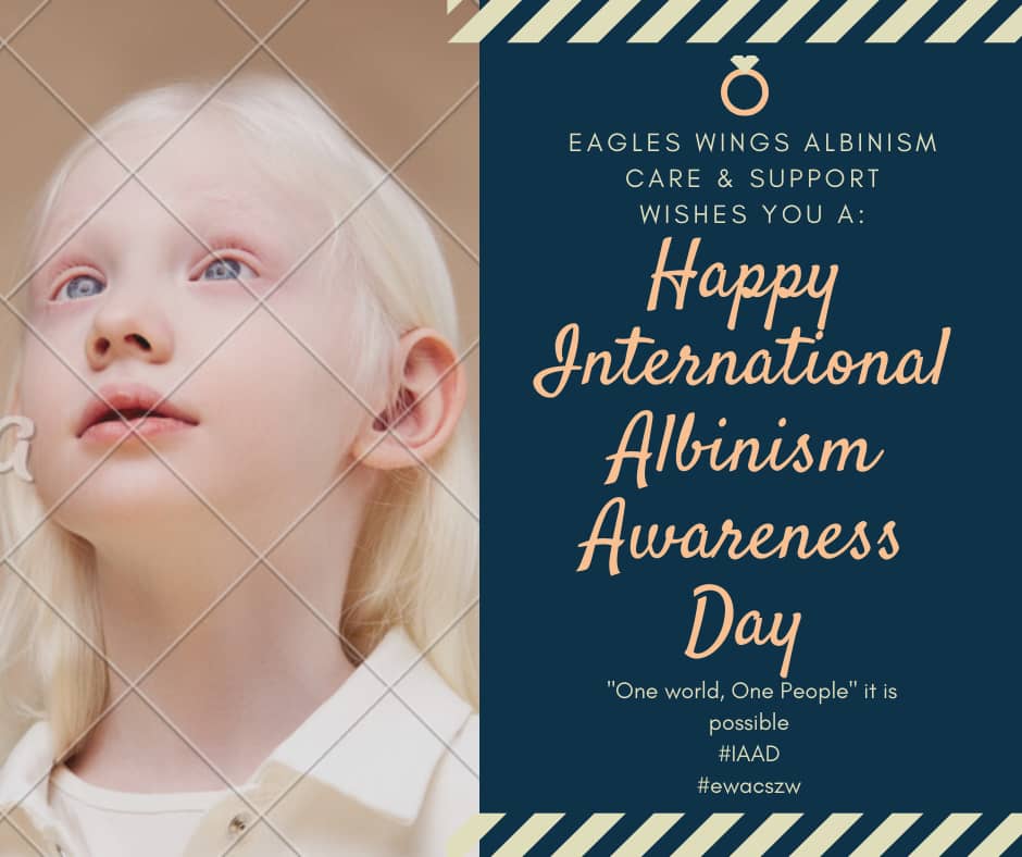 Today, 13th June we join the entire Albinism community globally in celebrating the International Albinism Awaeeness Day. Let’s not forget that beyond the celebration there is a lot of work to be done in creating a truly open and united society. #IAAD #Albinismisbeautiful #ewacszw