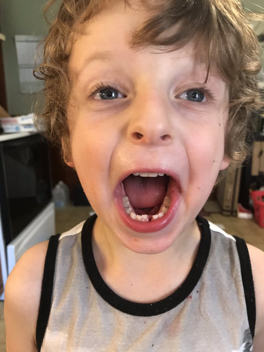 writestuffkarm's tweet image. When your last baby lost his first tooth. #sentimental #losttooth