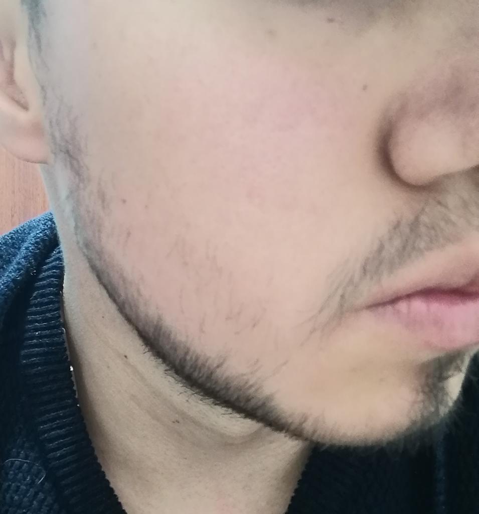 Diario_Minox_'s tweet photo. Llevo desde el primero de junio, usando MINOXIDIL KIRKLAND AL 5% para hacer crecer la barba, hoy día 12 decidí rebajar con máquina con el cabezal N° 1, fotos diarias del crecimiento y del tratamiento. https://t.co/aDnnPZQ33h