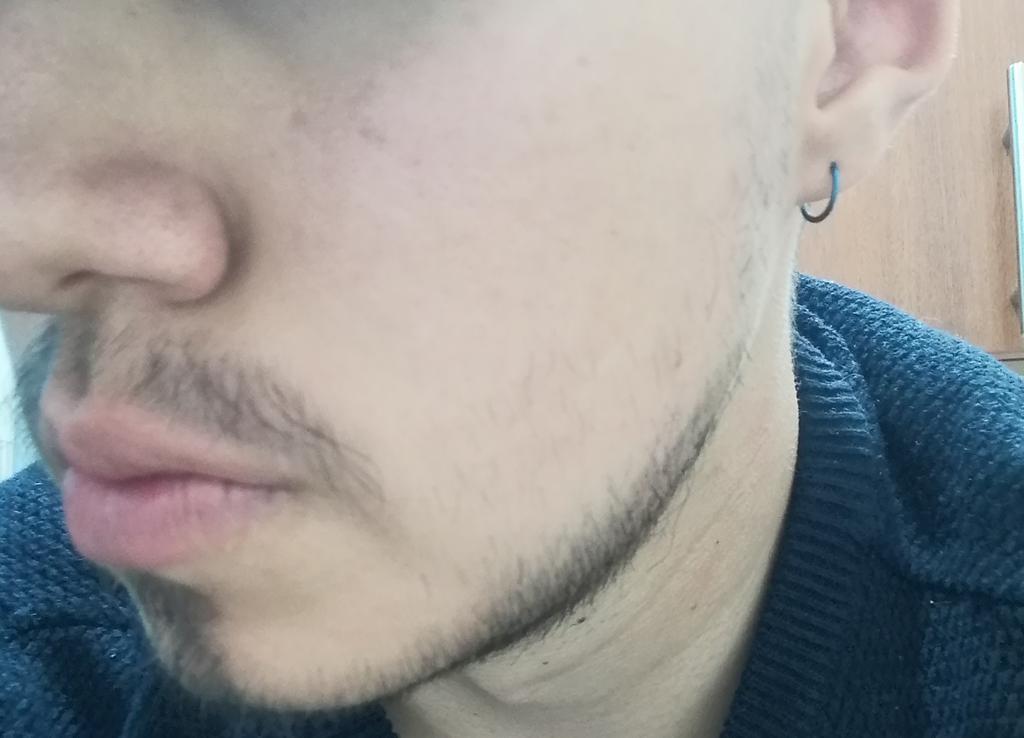 Diario_Minox_'s tweet photo. Llevo desde el primero de junio, usando MINOXIDIL KIRKLAND AL 5% para hacer crecer la barba, hoy día 12 decidí rebajar con máquina con el cabezal N° 1, fotos diarias del crecimiento y del tratamiento. https://t.co/aDnnPZQ33h