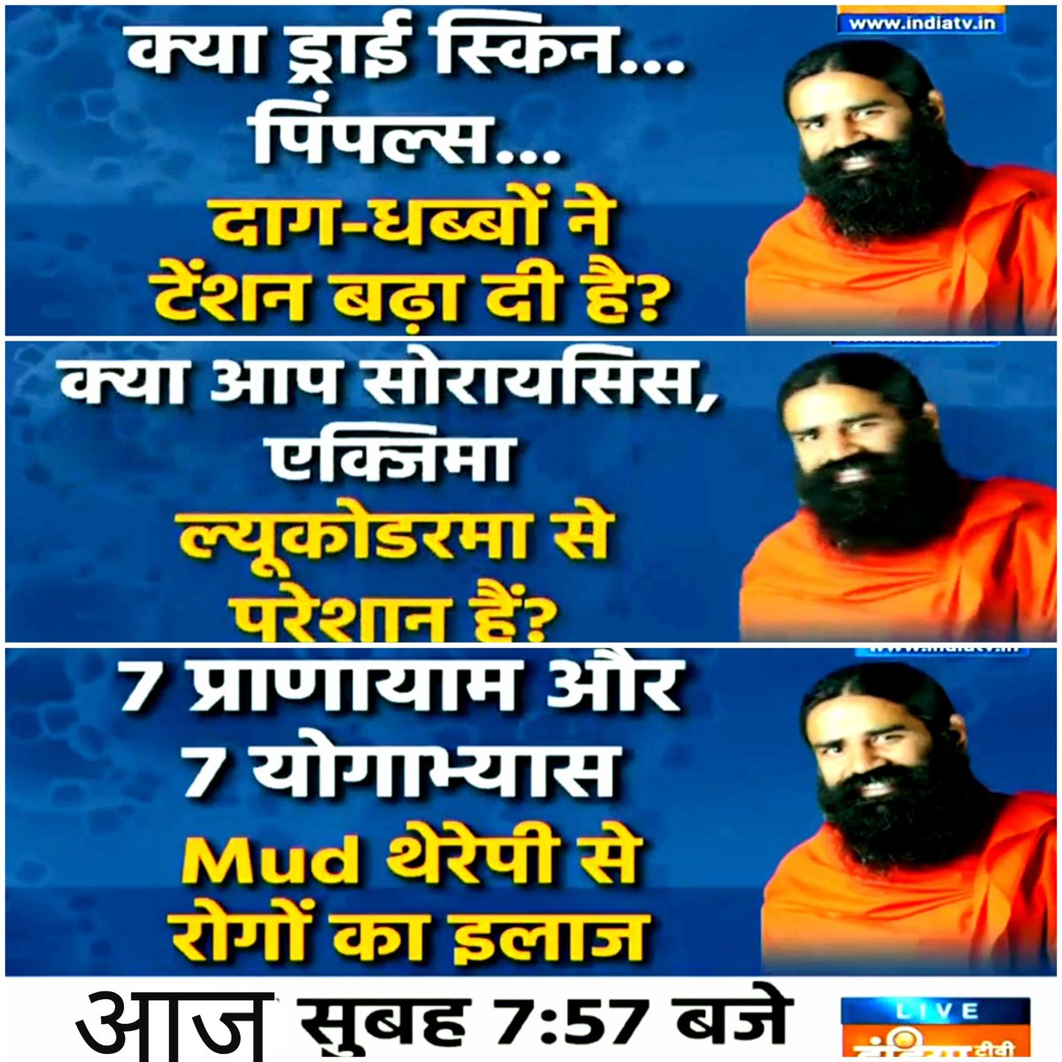 Kshitish_PYP's tweet photo. #जरूर_देखें @IndiaTVHindi
#13thJUNE_7_57AM
#YOG4YourSkinProblems
#Psoriasis #Eczema #Leukoderma
#MudTherapy
आज स्वामीजी से जाने #SKIN का हर समस्या के लिए #YOGयोग
पूछें अपना सबाल
देखें @indiatvnews परमपूज्य @yogrishiramdev के साथ
@swabhimani1 @bst_official
#SaturdayMotivation https://t.co/6Q3MGhjkwg