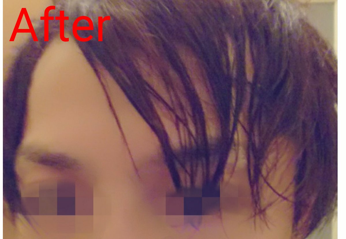E6 B1 Ba 81 97 81 A6 A3 Af E5 Be 8c 81 81 Af 81 81 84 Twitter Search E6 B1 Ba 81 97 81 A6 A3 Af E5 Be 8c 81 81 Af 81 81 84 Twitter Search