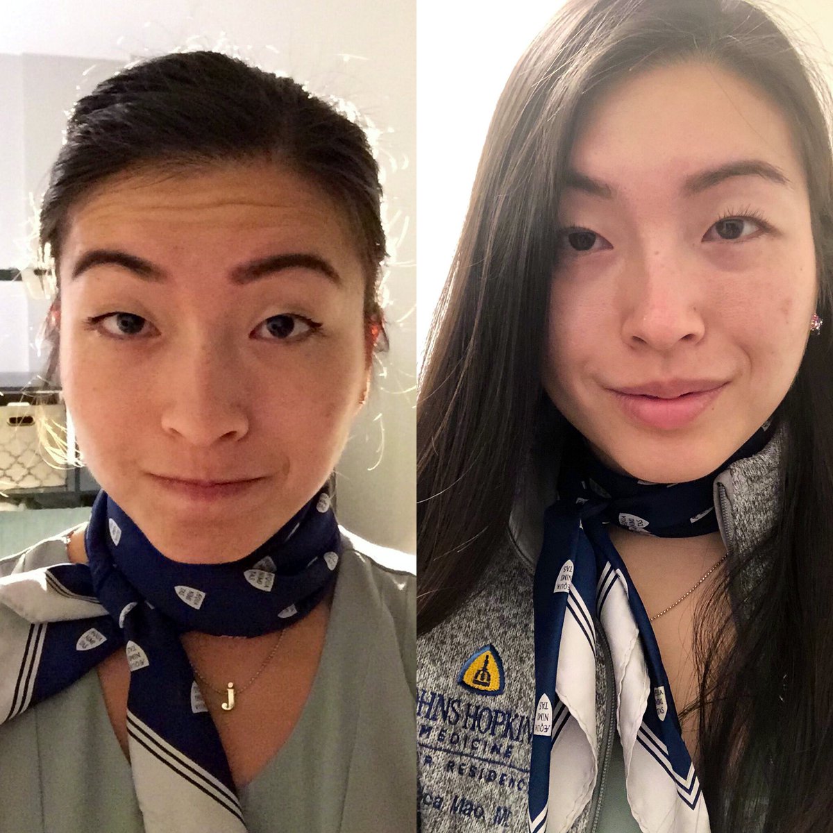 Jessica Mao (@jess_mao) on Twitter photo First and last Friday tie (i.e. scarf) day.
Left: July 2017
Right: June 2020
Differences: more anxious appearing in 2017, skin tone paler in 2020, under-eye circles deeper in 2020, huge sense of accomplishment in 2020
#aequanimitas
<a href="/OslerResidency/">The Osler Medical Residency</a>
<a href="/JohnsHopkinsDOM/">Johns Hopkins Department of Medicine</a> First and last Friday tie (i.e. scarf) day.
Left: July 2017
Right: June 2020
Differences: more anxious appearing in 2017, skin tone paler in 2020, under-eye circles deeper in 2020, huge sense of accomplishment in 2020
#aequanimitas
<a href="/OslerResidency/">The Osler Medical Residency</a>
<a href="/JohnsHopkinsDOM/">Johns Hopkins Department of Medicine</a>
