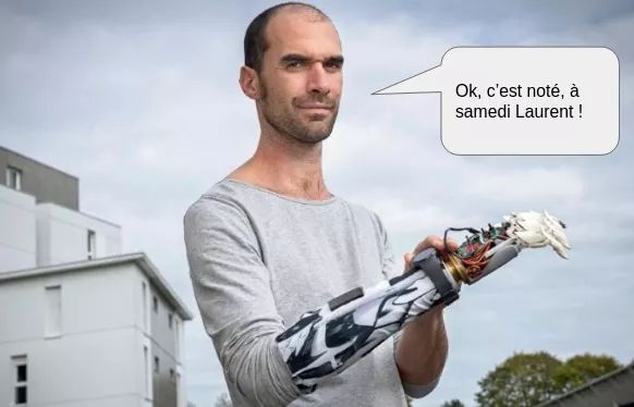 nicop35's tweet photo. Ne ratez pas la diffusion du reportage “Bionico, l’homme bionique” aujourd'hui à @13h15 sur @France2tv  📺 @bionicohand ou Nicolas Huchet est l'un des co-fondateurs de l’association rennaise @MyHumanKit 😉♿ #makers #Handicapowerment #OpenSource #FabLab CC @LaurentDelahous 👍😀👏 https://t.co/cefPXcVdDF