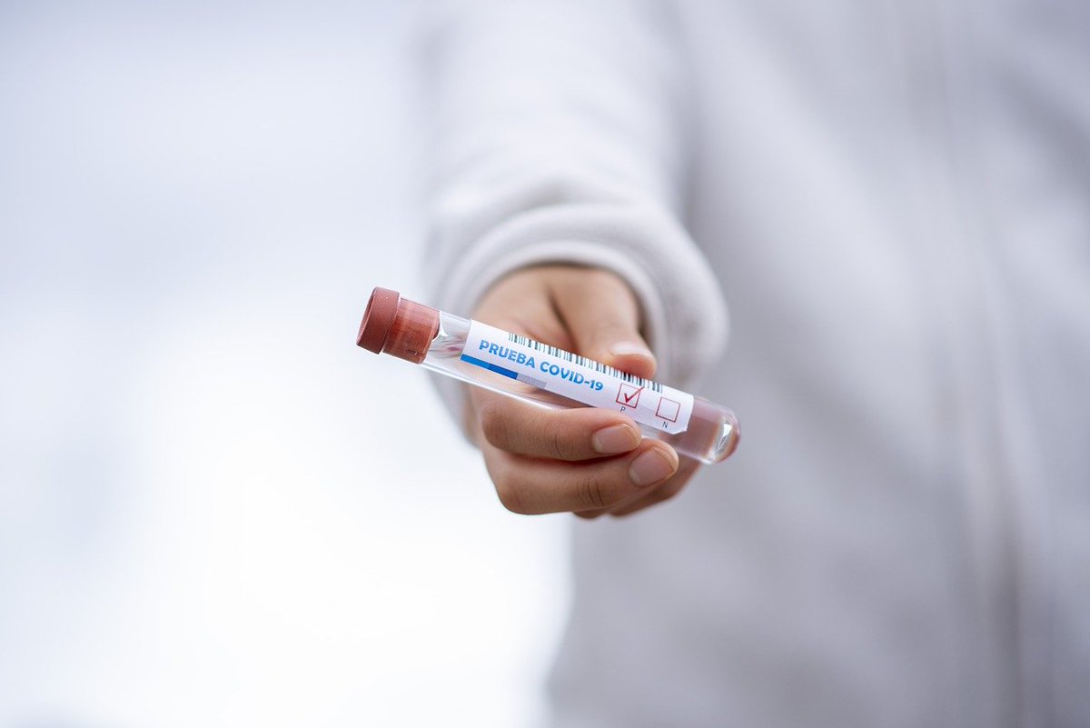 Eurosurveillanc's tweet photo. #Metaanalysis of #DiagnosticPerformance of #SerologicalTests for #SARSCoV2 #antibodies up to 25 April 2020 and #PublicHealth implications https://t.co/vyqbLtMfN3

#coronavirus #COVID19 #RandomEffectsModels #IgM #IgG #assays  #diagnositics https://t.co/v4RW5guGqY