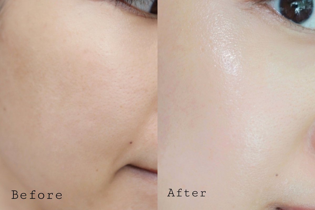 inkmaya's tweet photo. ใช้มาสักพักของเค้าดีจริงๆตัว Hya First serum ของยูเซอริน ผิวกระชับขึ้น พวกริ้วรอยเล็กๆ มันดีขึ้นจริงๆ  แล้วหน้าอิ่มฟูชุ่มชื้นเหมือนหน้าฉันบำรุงมาอย่างดี ผิวเนียนละเอียด เอ่อตอนทาเซรั่มลงผิว เหมือนผิวหน้าแน่นเด้งกระชับทันทีอ่ะเป็นงง คุ้มค่ามาก  #ใช้จริงรีวิวจริง #howtoperfect https://t.co/o3fMvrtqTs
