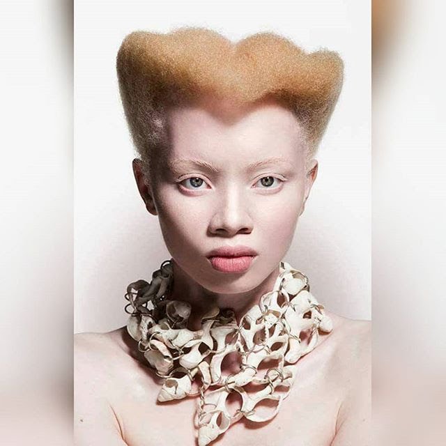 casspernyovest's tweet photo. Happy international albinism awareness day as declared by the United Nations. This is Thando Hopa! A South African model, lawyear and activist who made history by being the first woman with albinism on on Vogue cover when she graced the cover of Vogue Portugal. All the flowers!!! https://t.co/72VQCmv28j