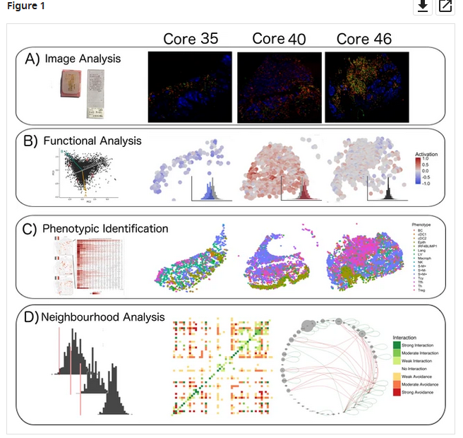 WEBforSCIENCE's tweet photo. Functional heterogeneity of lymphocytic patterns in primary melanoma dissected through single-cell multiplexing #DimetPhD @UNIMIB https://t.co/BTNzTOU01G https://t.co/UfgvmtF9xq