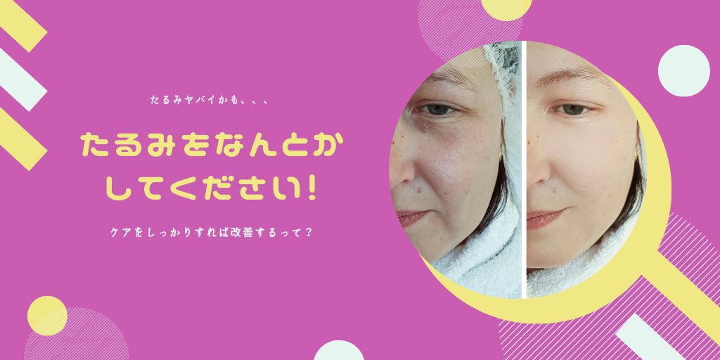 頬引き締め
