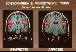 PruthaGoa's tweet photo. Shunning the Stigma of Schizophrenia
https://t.co/HCKedZnp8w
#NGO #NGOs #Schizophrenia #RemovetheStigma #SchizophreniaManagement #Counselling #Psychotherapy #Healing #COOJ #CauseofOurJoy #MentalHealthFoundation #PositiveNewsinGoa #PositiveNews #Goa #MentalHealth #PruthaGoa https://t.co/PlFWqMUoL0