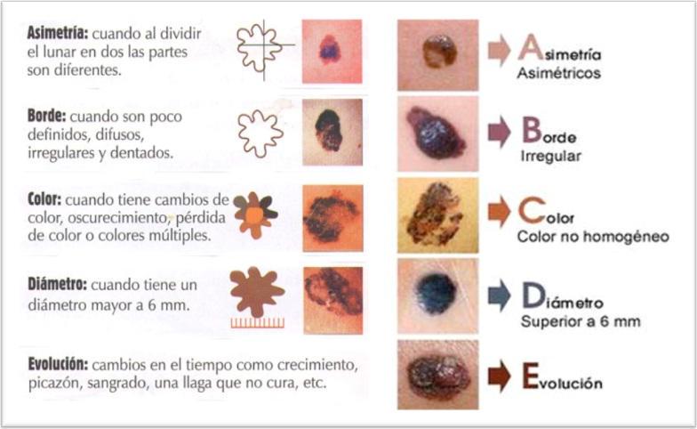AGomezlorca's tweet photo. Hoy es #DiaEuropeoPrevencionCancerdePiel. Me sorprende como la gente no cuida la piel, el órgano más grande del cuerpo, y que cualquier lesión solar es muy peligrosa. 🙈 #CuidaTuPiel #ProteccionSolar #CáncerDePiel #YoUsoHeliocare #HELIOCARE https://t.co/APgIMPACO4
