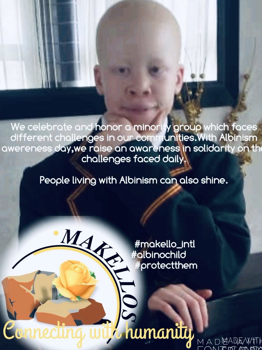 makellos_intl's tweet photo. #albinochildmatters #connectingwithhumanity https://t.co/pHfPLPYv6M