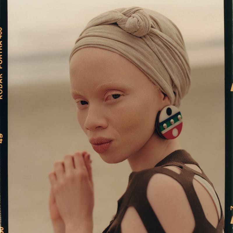 ZFSUK's tweet photo. Celebrating @thandohopa who is a South African model, activist, and lawyer. She is the first woman with albinism to be on the cover of @voguemagazine. While working as a prosecutor, she was scouted by @gertjohan to work as a model.-😍 #InternationalAlbinismAwarenessDay https://t.co/bh7eUEXNYp