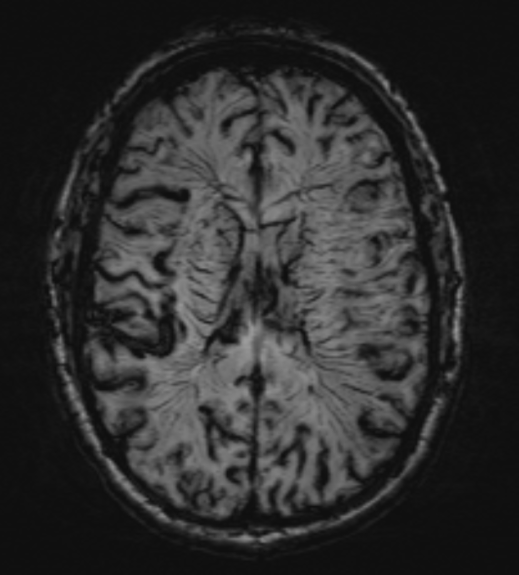 UMaryland Neuroradiology tweet media