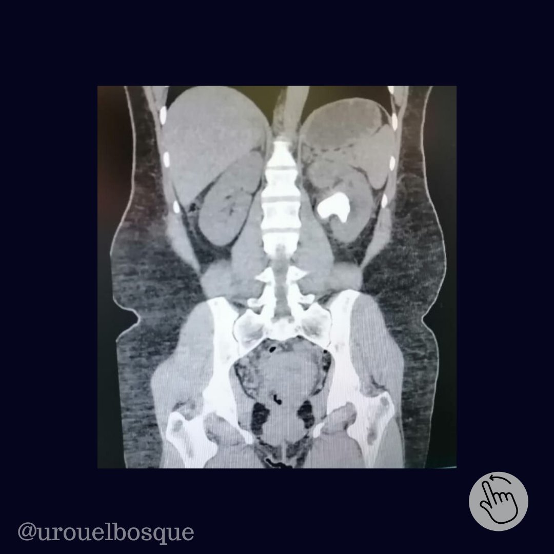Urología Universidad El Bosque tweet media