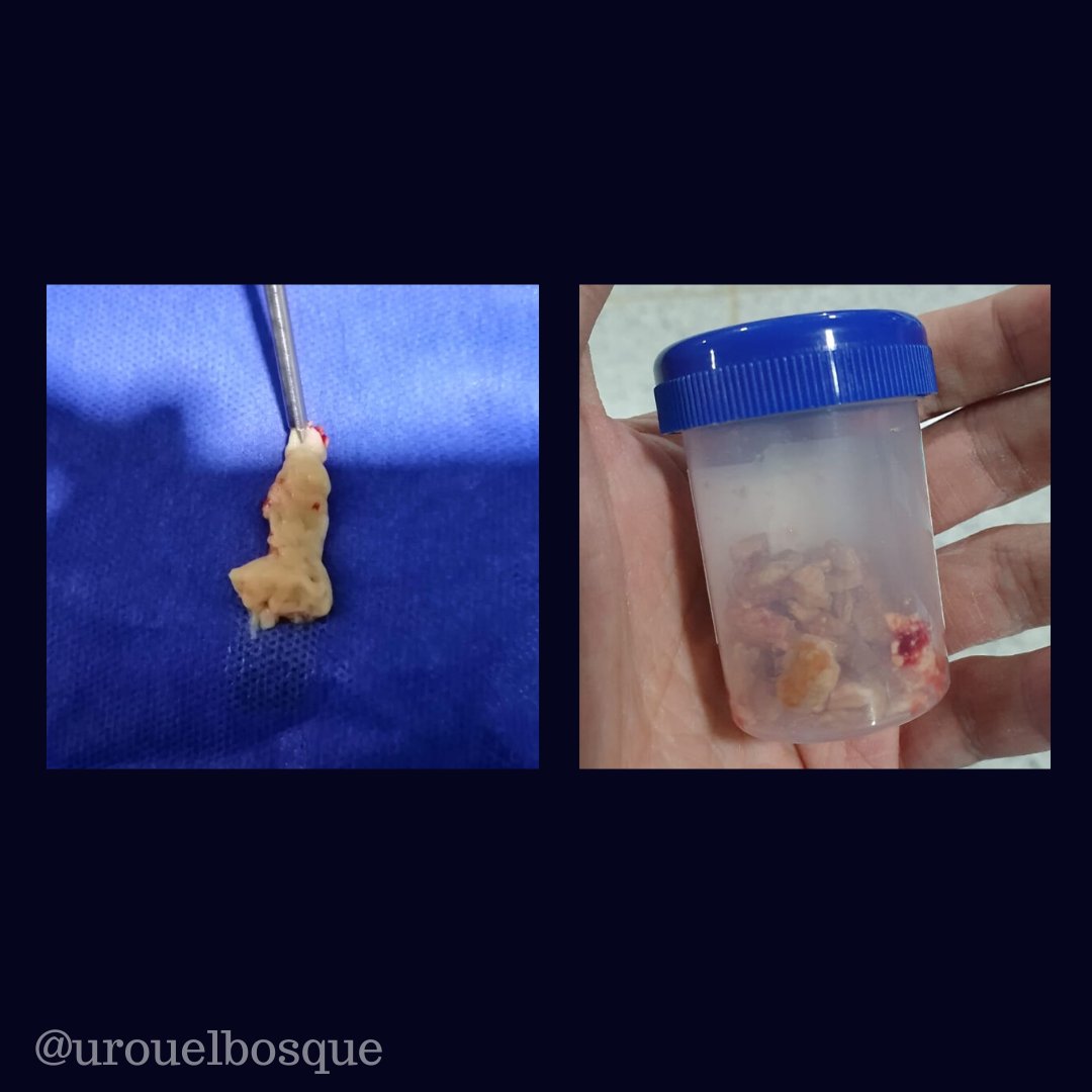 Urología Universidad El Bosque tweet media