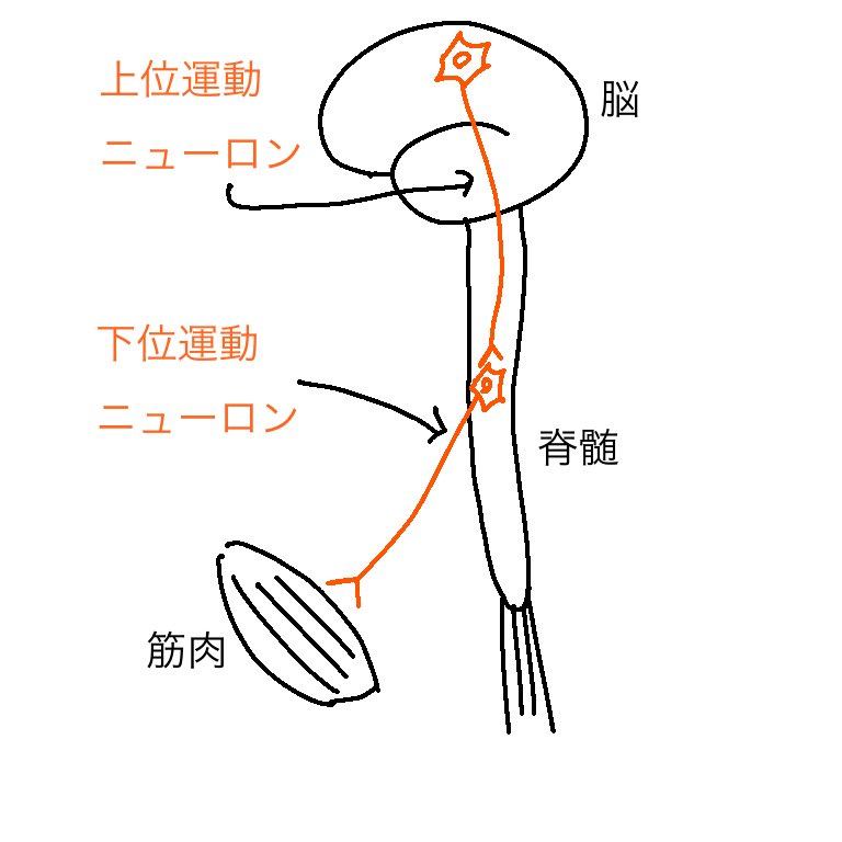 上位 運動 ニューロン 障害