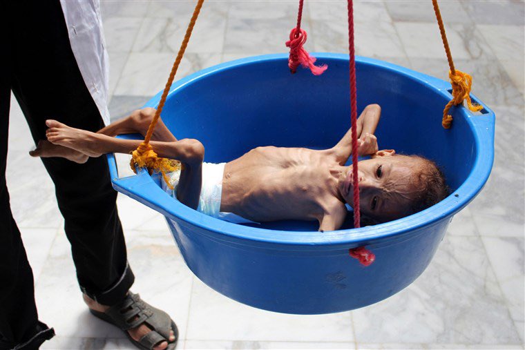 SlimmySlim94's tweet photo. Yemen is on the Verge of EXTINCTION and Nobody cares.

No media coverage or news outlets talk about what’s going on Yemen

22 million People (3 quarters of the population) need humanitarian aid!

Please help and donate - https://t.co/Tq2m1aFiIP

A simple RT can do a lot 🙏🏻 https://t.co/4oK88qWKQG