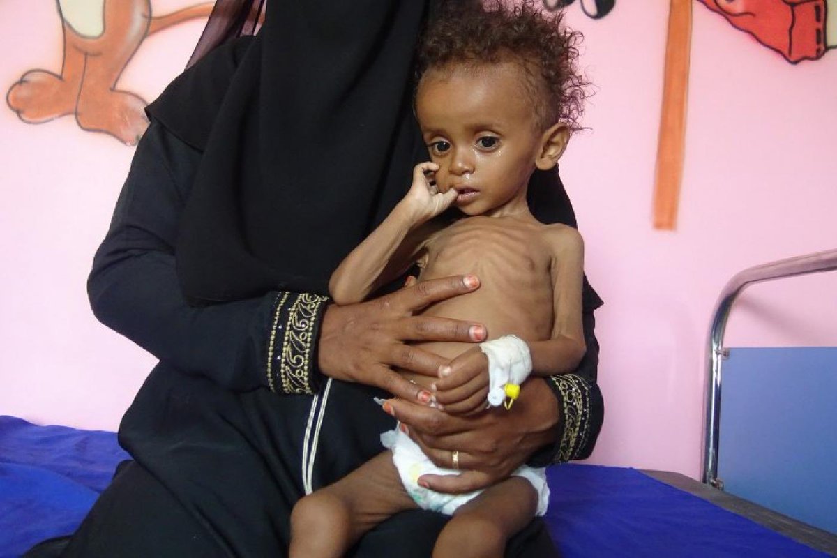 SlimmySlim94's tweet photo. Yemen is on the Verge of EXTINCTION and Nobody cares.

No media coverage or news outlets talk about what’s going on Yemen

22 million People (3 quarters of the population) need humanitarian aid!

Please help and donate - https://t.co/Tq2m1aFiIP

A simple RT can do a lot 🙏🏻 https://t.co/4oK88qWKQG
