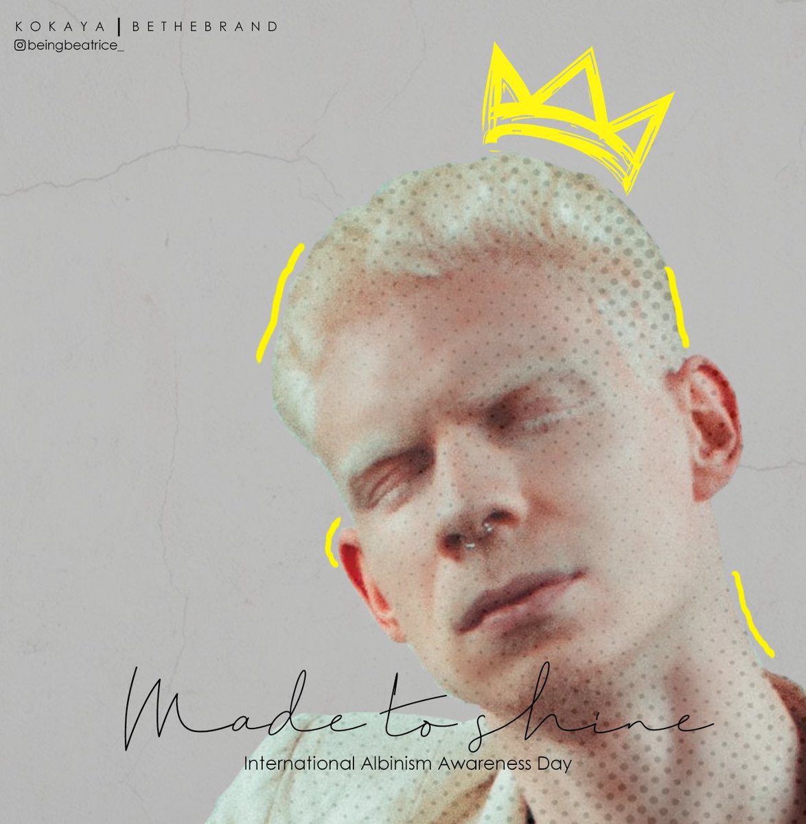 Today, we stand together with people with albinism all over the world in their fight to live a life that is free of stigma, discrimination, fear and violence. A world where they are made to shine. 
INTERNATIONAL ALBINISM AWARENESS DAY
#MadeToShine