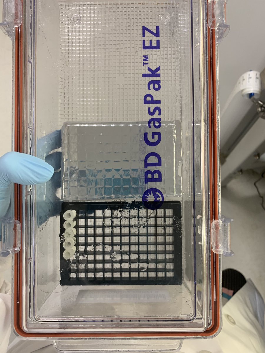 Samples from inpatients get transferred into special long-term storage tubes, and the rest of the plate gets covered with an adhesive foil seal. The rest of the process is just cleanup. [14/n]