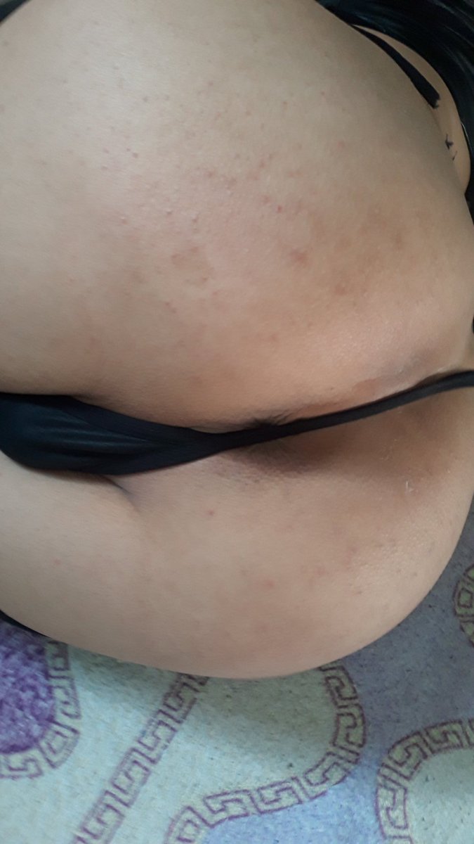 Sakaryada şuan görüşebilecek genç aktif varsa dm yazsın 💋 <a href="/gayarabul/">❤️GAY ARA BUL❤️</a>