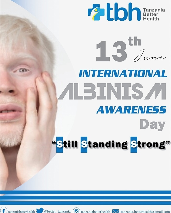 Its never to late to still keep the day bright.. With lots of love ❤️

#albinism #albino #albinismawareness #albinismisbeautiful #albinomodel #internationalalbinismawarenessday #albinogirl #love #albinismbeautiful #albinisminafrica